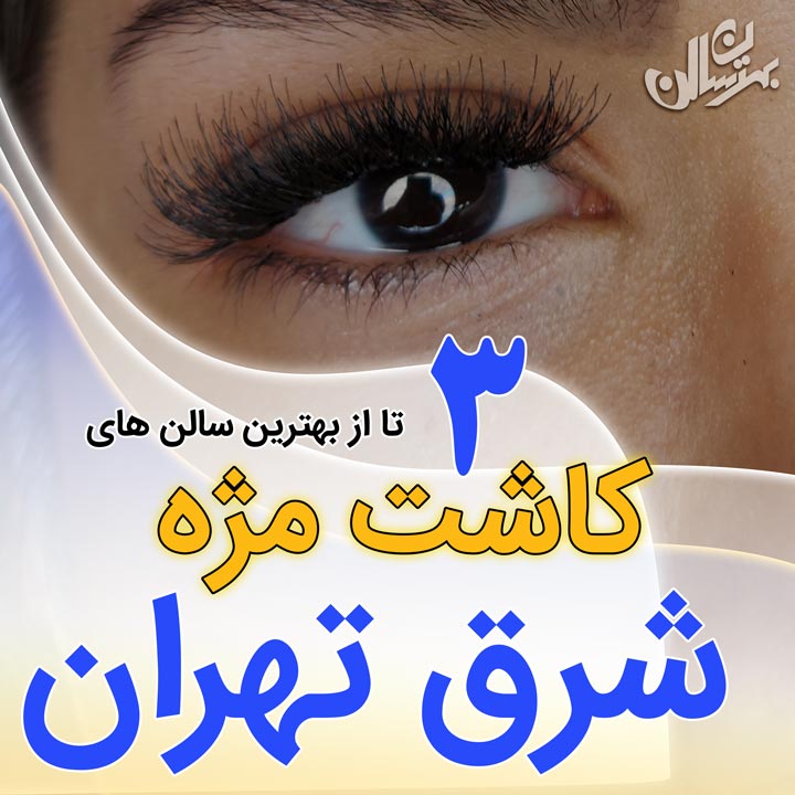 کاشت مژه شرق تهران