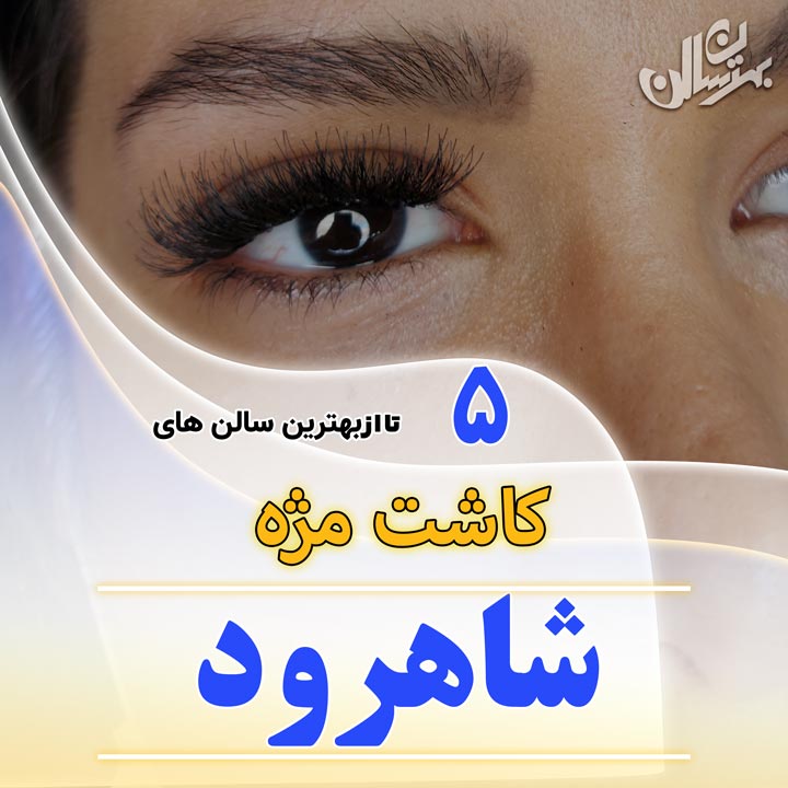 کاشت مژه شاهرود