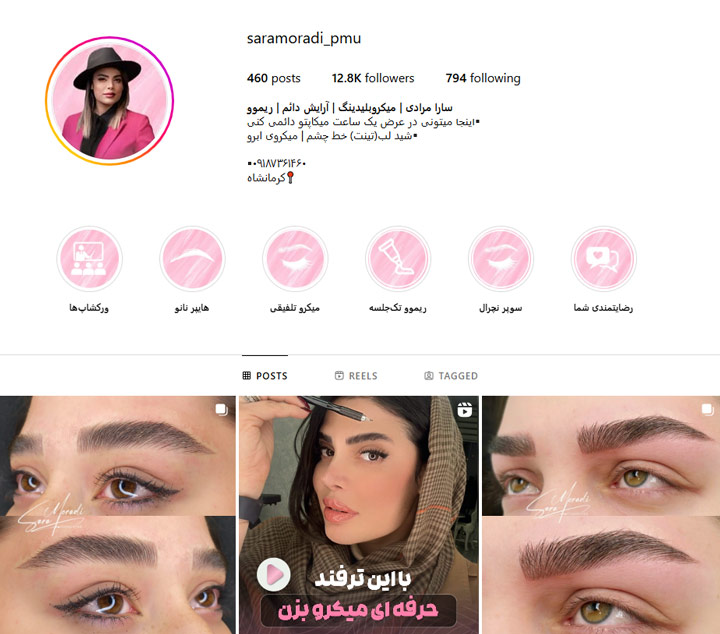 بهترین مرکز تخصصی فیبروز و تاتو ابرو در کرمانشاه