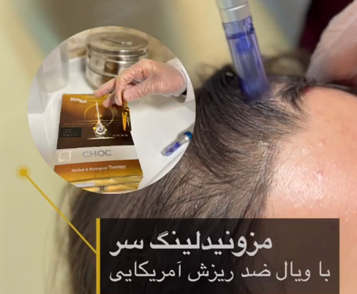 بهترین کلینیک مزوتراپی مو در قم