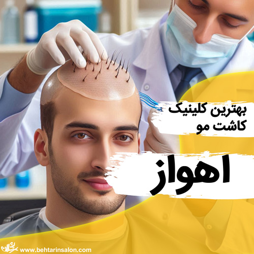 کاشت مو اهواز