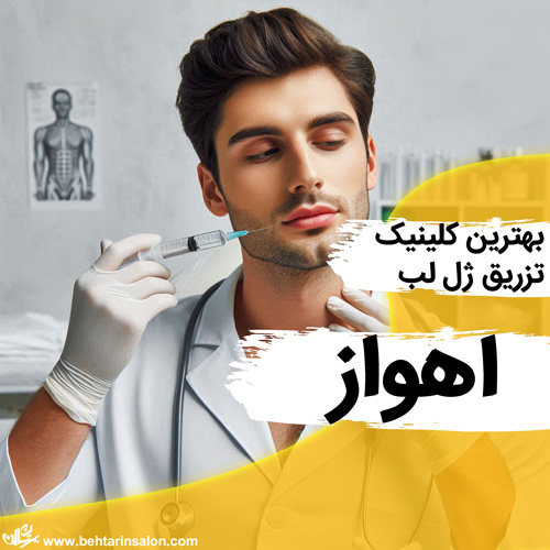 ژل لب اهواز