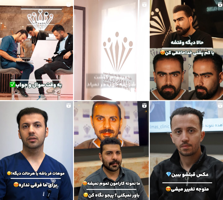 کلینیک زیبایی الماس تبریز