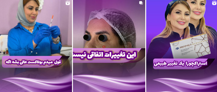 بهترین کلینیک بوتاکس صورت در اهواز