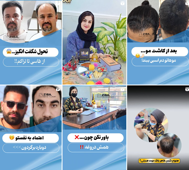 مرکز کاشت مو دکتر زیبا مهدی پور