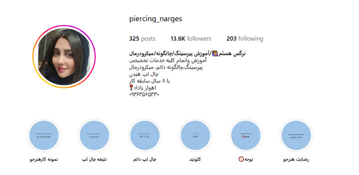 مرکز تخصصی چال گونه نرگس در اهواز