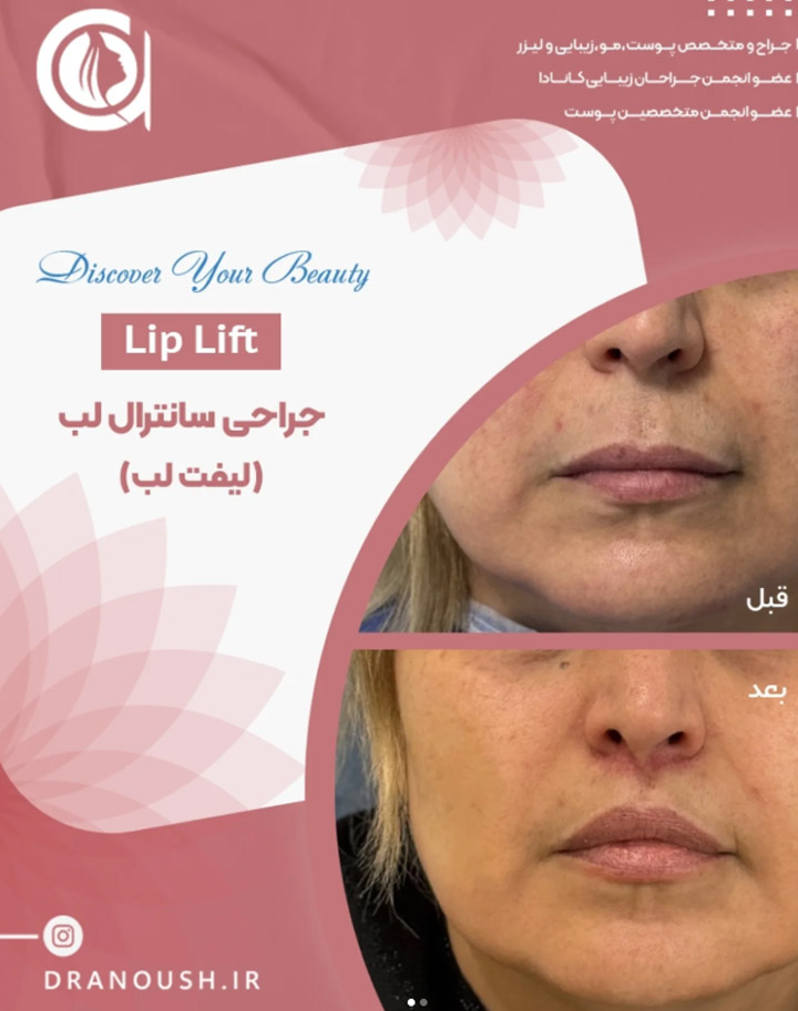 بهزاد انوش تبریز