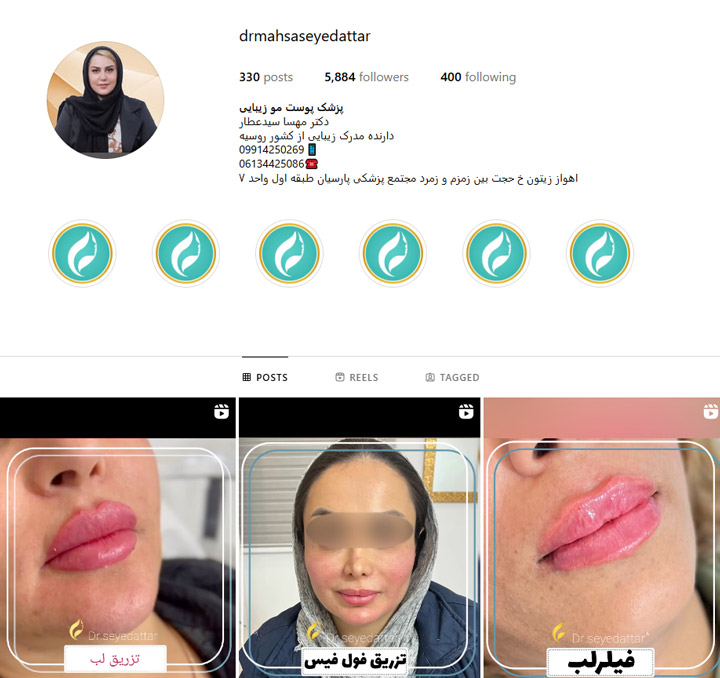 بهترین مرکز تزریق ژل گونه اهواز