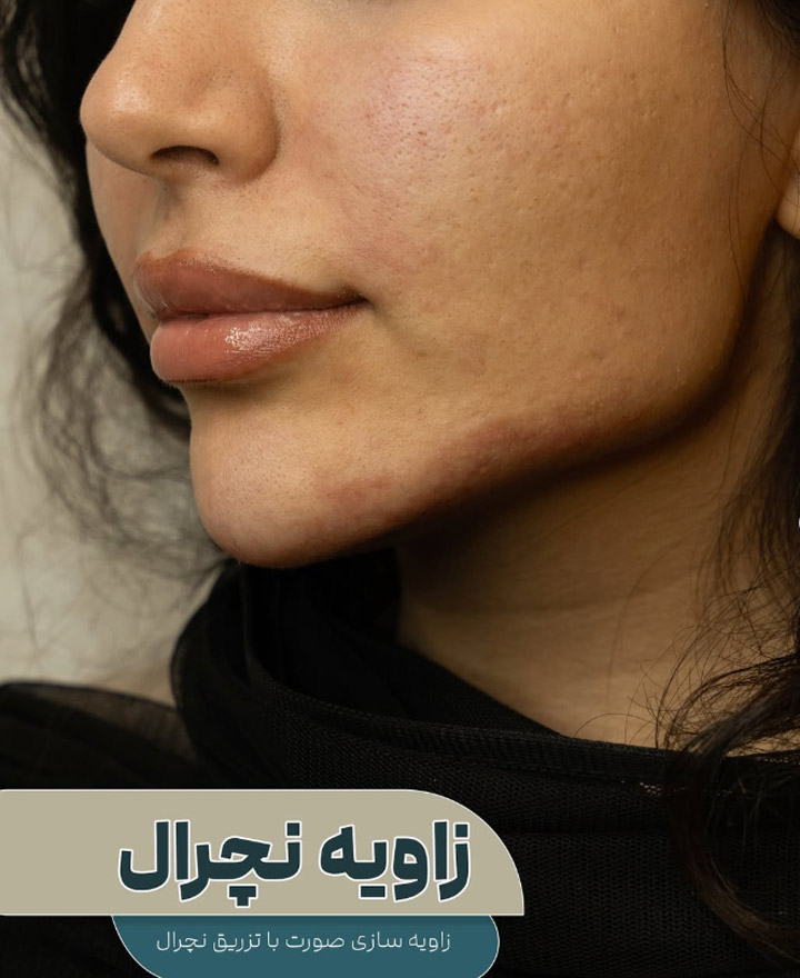 کلینیک زیبایی دکتر مهدی حقیقی تبریز