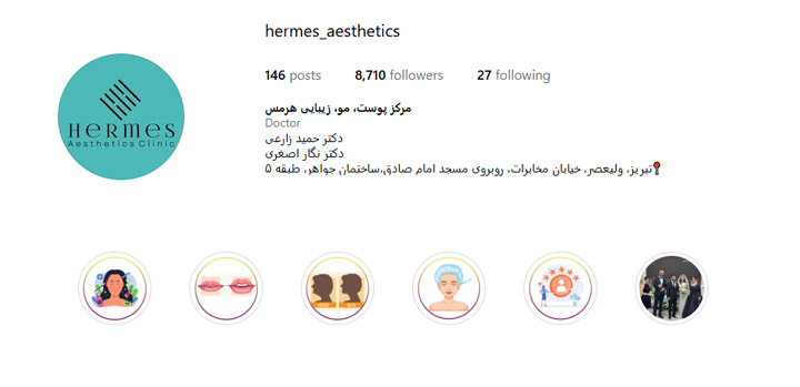 فیلر گونه تبریز