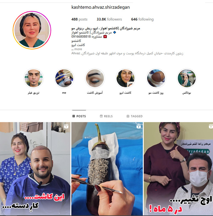 بهترین کلینیک کاشت مو اهواز