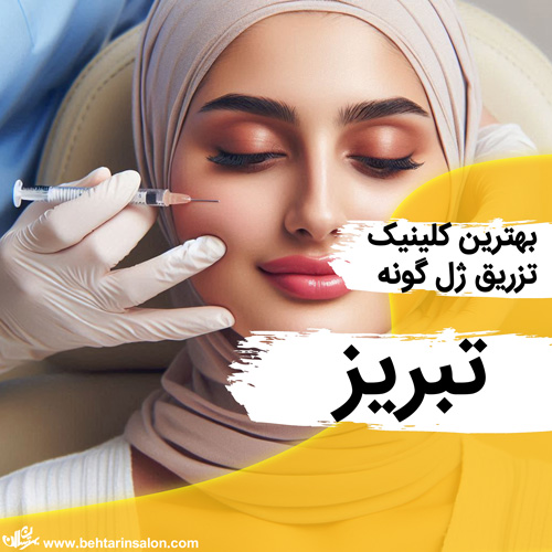 ژل گونه تبریز