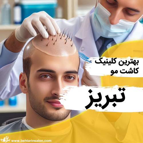 کاشت مو تبریز