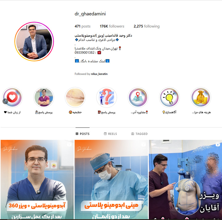 دکتر لیپوساکشن در تهران