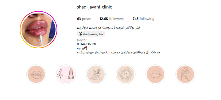 فیلر گونه شادی جوانی