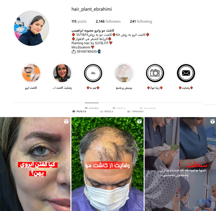 متخصص کاشت ابرو دکتر محبوبه ابراهیمی
