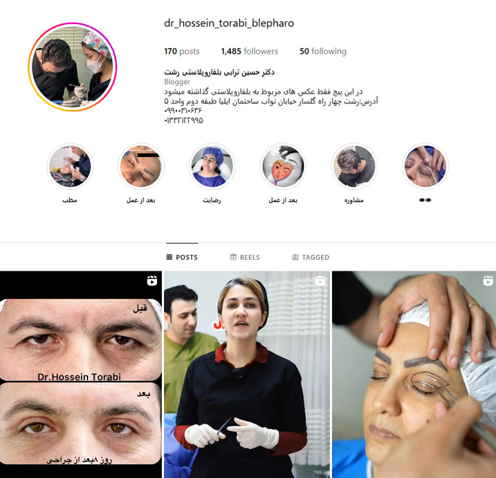 متخصص بلفاروپلاستی رشت