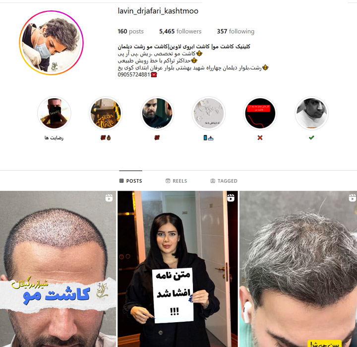 کاشت مو دکتر جعفری