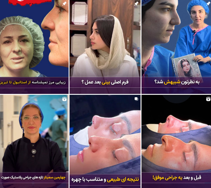 دکتر شبنم حاجی علیپور تبریز