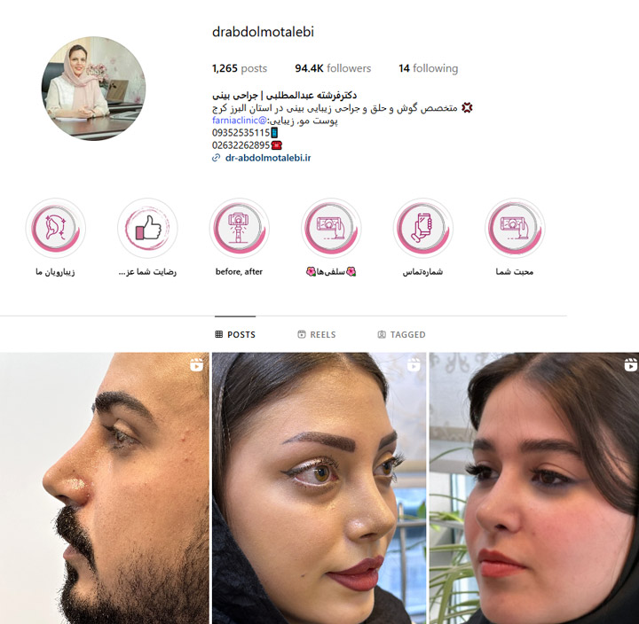 معروف ترین پزشک جراحی بینی در شهر کرج