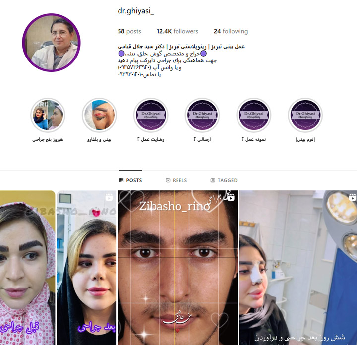 جراح بینی دکتر قیاسی