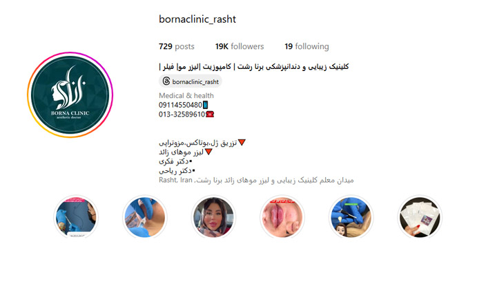 بوتاکس گونه در رشت