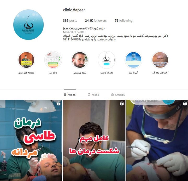معروف ترین کلینیک کاشت موی رشت