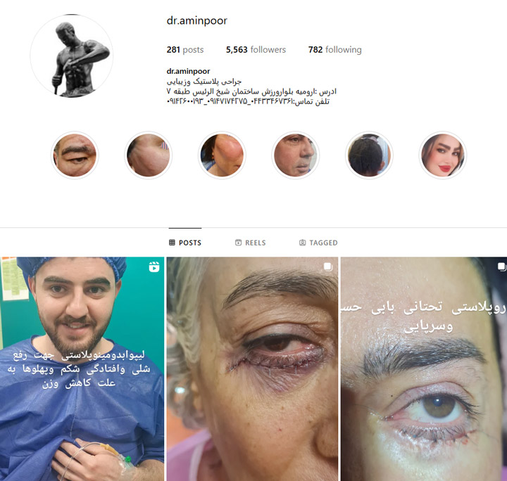 دکتر امین پور جراح پلک ارومیه