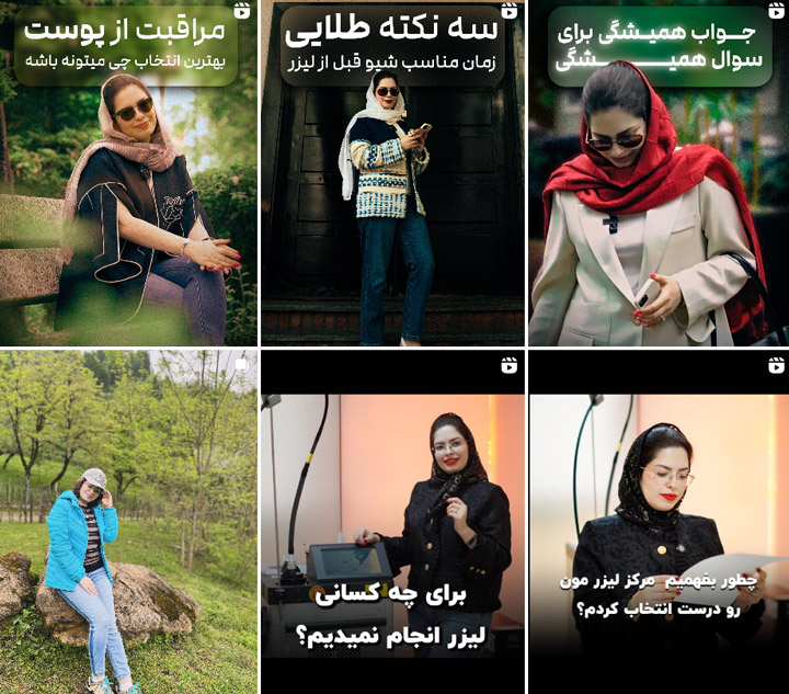 هایفوتراپی زیر چشم رشت