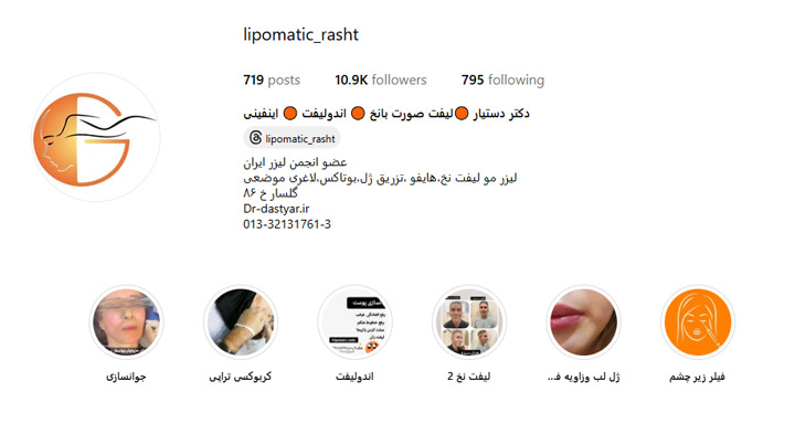 لیفت زاویه فک با نخ در رشت