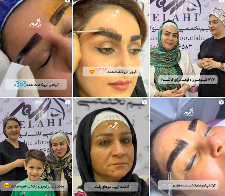 دکتر معصومه الهی کاشت ابرو