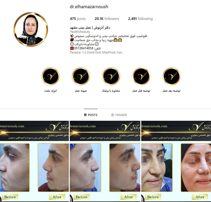 متخصص جراحی بینی در مشهد
