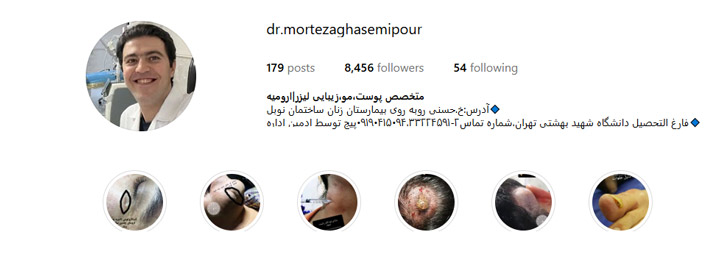تزریق چربی دکتر قاسمی پور