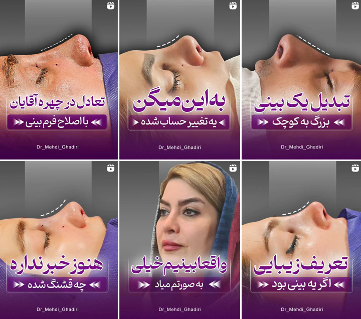 بهترین جراح بینی در شهر اصفهان
