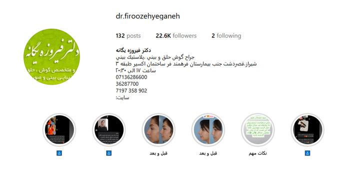 عمل زیبایی بینی در شیراز