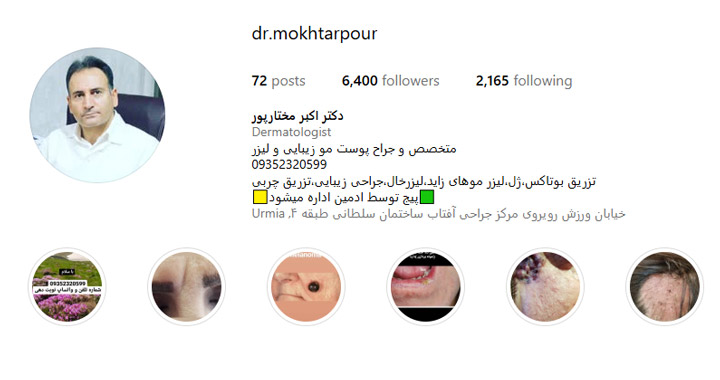 تزریق چربی به لب در ارومیه