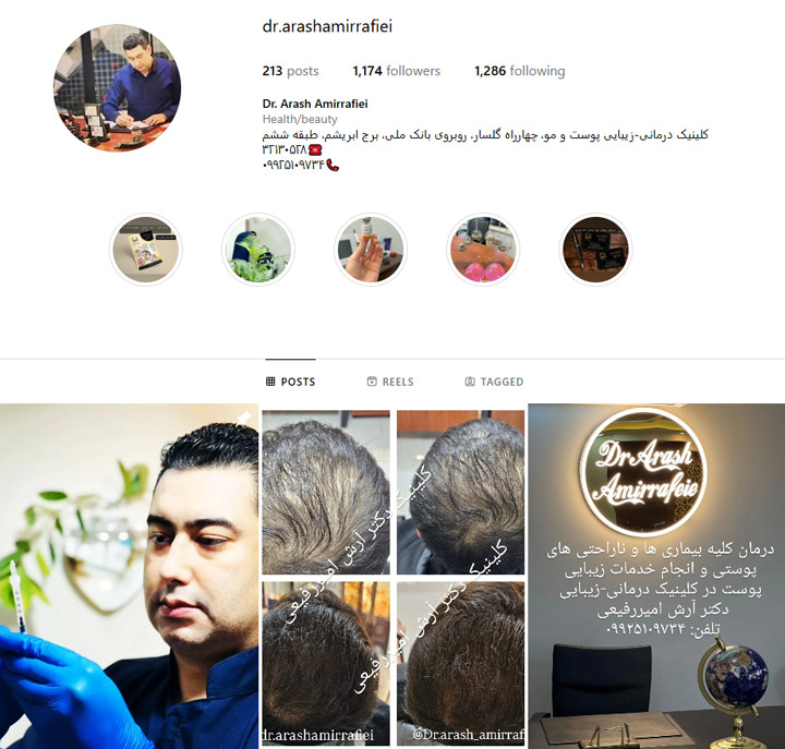 متخصص مزوتراپی مو رشت