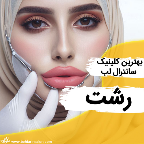 عمل سانترال لب رشت