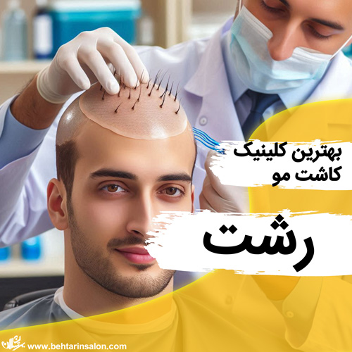 کاشت مو رشت
