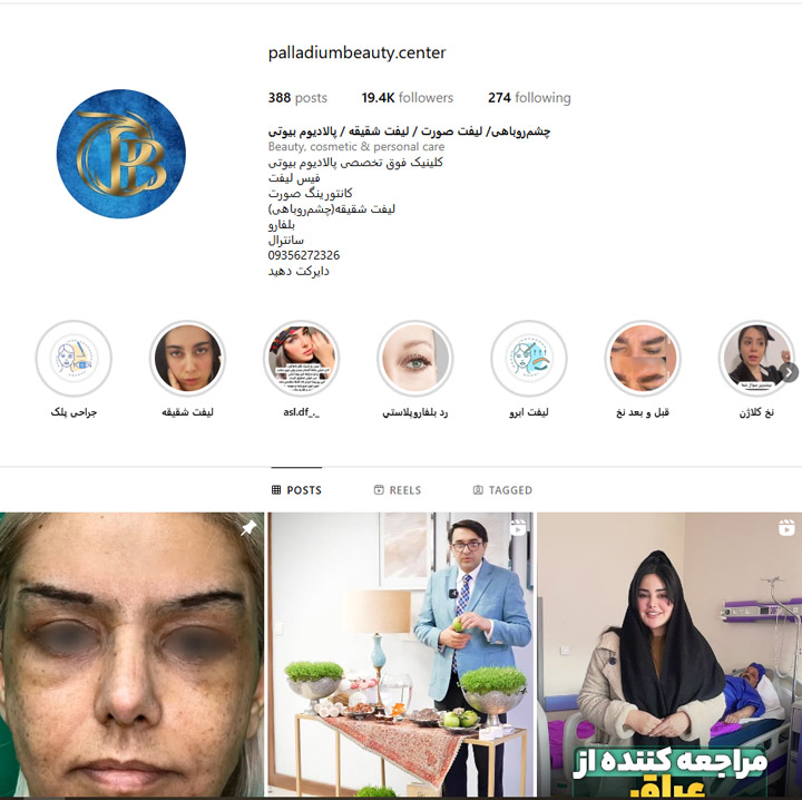 بهترین مرکز لیفت صورت در تهران