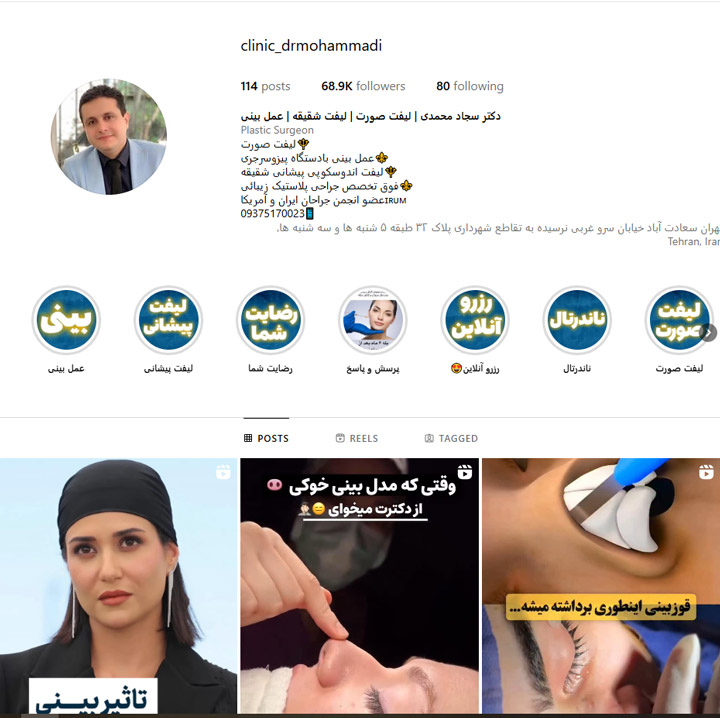 دکتر فیس لیفت سجاد محمدی در تهران