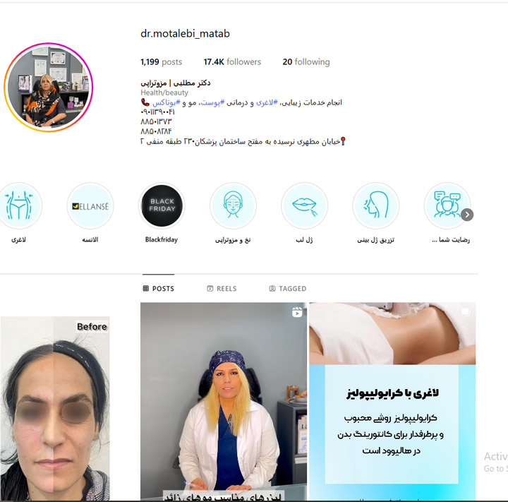 بهترین کلینیک مزو تراپی پوست در تهران