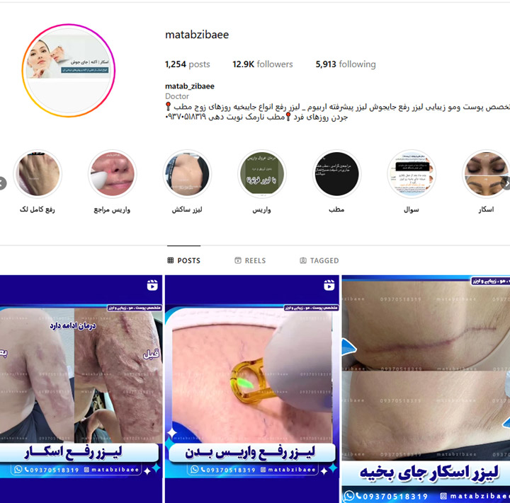 مطب زیبایی در تهران