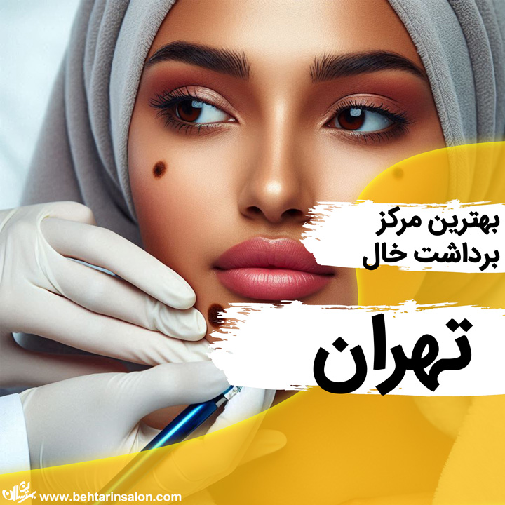 برداشت خال تهران