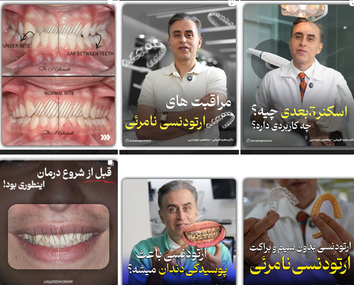 معروف ترین مرکز ارتودنسی دندان در قم