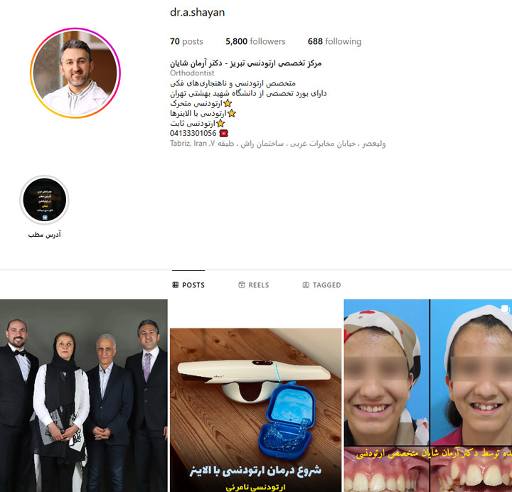ارتودنسی نامرئی در تبریز
