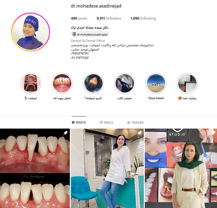 بهترین مرکز لمینت دندان در اصفهان