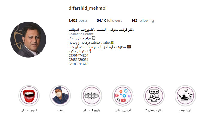 لمینت بدون تراش کرج