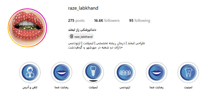 لمینت دندان در کرج