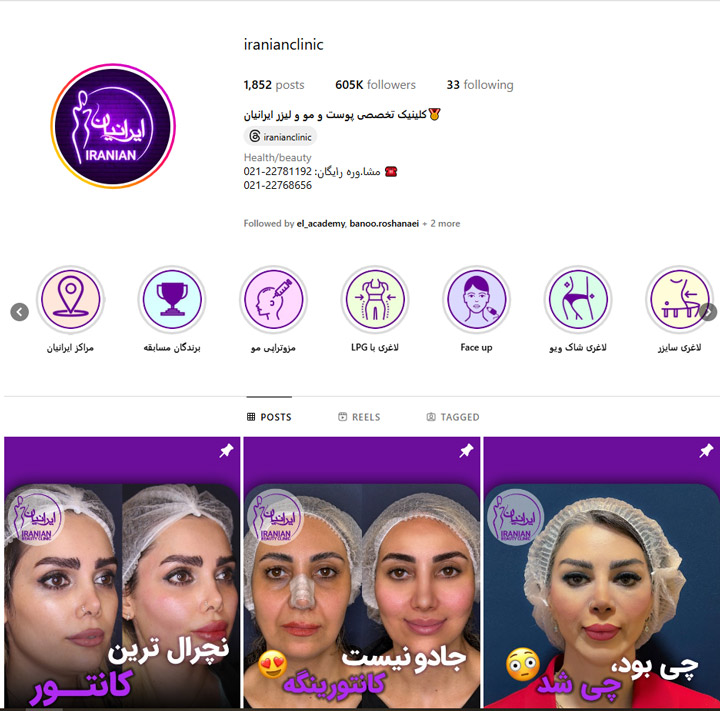 بهترین کلینیک لاغری با دستگاه در تهران